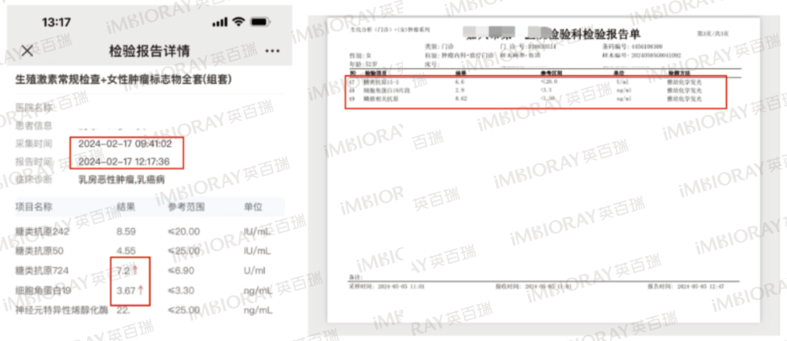 176767764465361668.png 55dc3e978e36a32e3e8fe7993cae683e.png