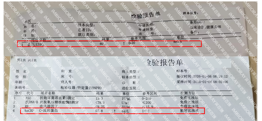 178159779733919180.png 屏幕截图 2026-06-15 164211.png
